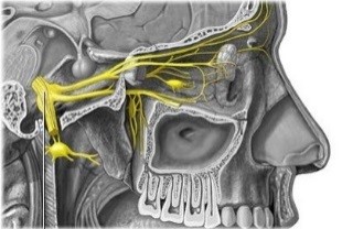 Cefalea en racimos en el nervio trigémino