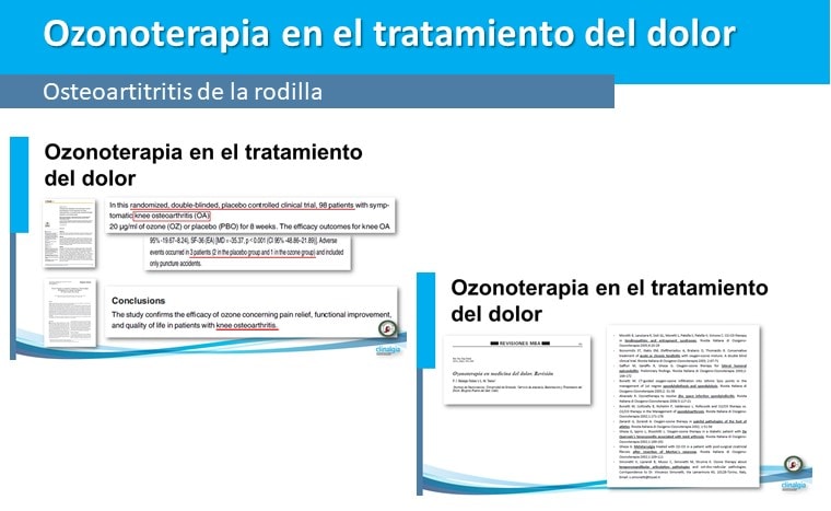 osteortritis de rodilla y ozonoterapia
