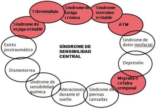 Síndrome de sensibilización central