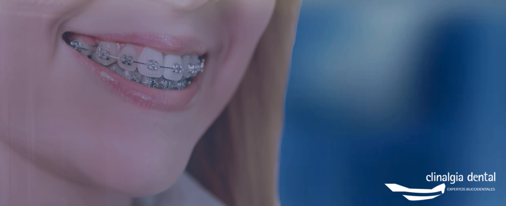 Ortodoncia Clinalgia Dental
