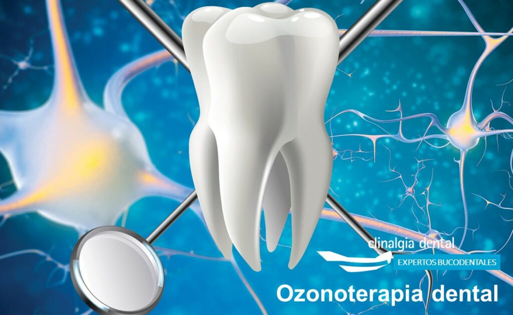 Ozonoterapia Bucodental | Clinalgia Dental