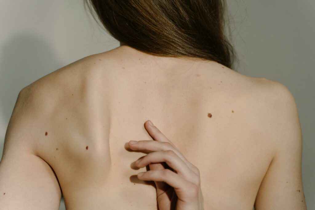Síntomas de la hernia discal