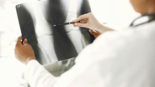 Tratamiento de ozonoterapia para artrosis de rodilla en clínica